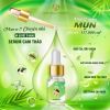 serum-diet-va-tri-mun - ảnh nhỏ  1